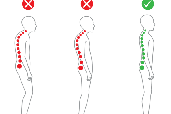 exercises to fix posture