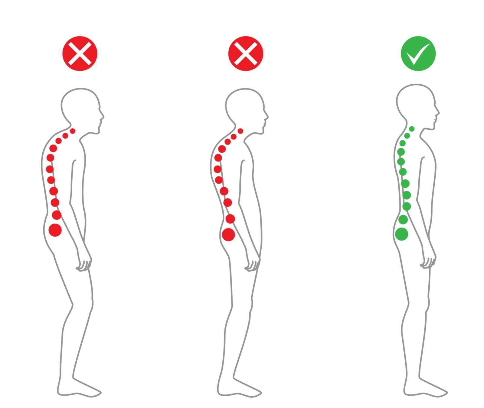 exercises to fix posture